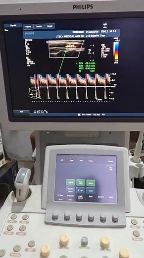 Philips iU22 Ultrasound Machine. +92 320 9531247
