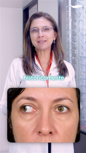 ¿Bizco y estrabismo son lo mismo?