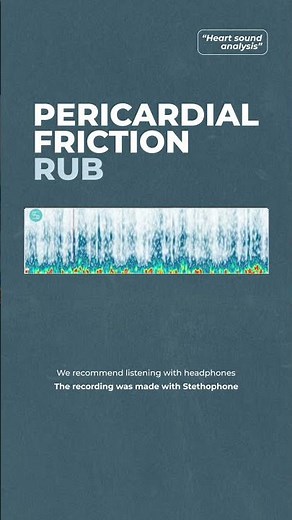 Pericardial friction rub
