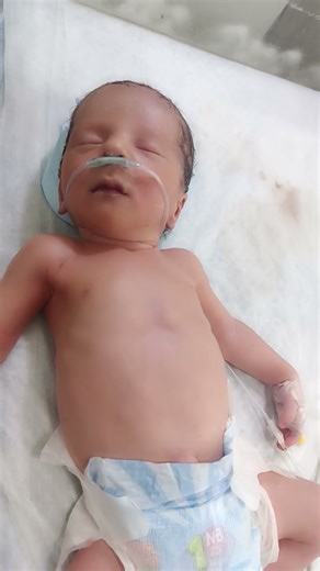 “Why Is My Baby’s Oxygen Saturation Low? | Expert Explanation” #babysaturationlow