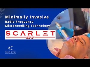 Short-Pulse Radiofrequency with microneedling | Why Should you Choose Scarlet SRF?
