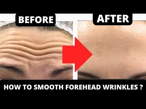 How to Remove Forehead Wrinkles Naturally – Face Exercises for Forehead Lines