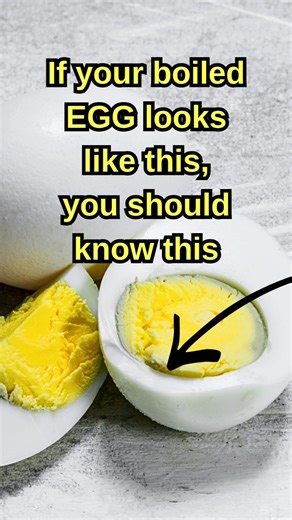 If Your Boiled Egg Looks Like This, You Should Know This | Eggs Benefits