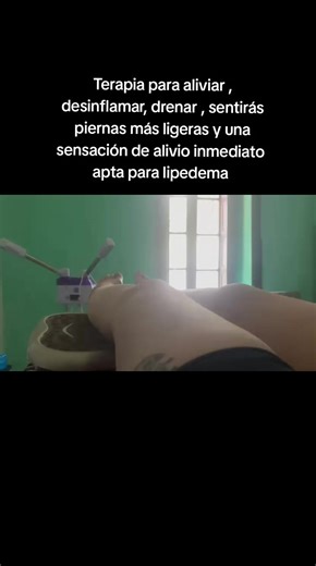 El lipedema es una enfermedad crónica y progresiva del tejido adiposo que causa una acumulación anormal y simétrica de grasa, principalmente en piernas, caderas y a veces brazos, respetando manos y pies. Afecta mayoritariamente a mujeres, provocando dolor, hematomas, pesadez y desproporción corporal. #lipedema#losandeschile🇨🇱