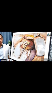 ER Thoracotomy หัตถการที่สุดของห้องฉุกเฉิน ผมวาดภาพนี้เพื่อระลึกถึงอาจารย์ศัลยกรรมท่านหนึ่ง ที่ผมมีโอกาสได้ร่วมเคสด้วยกัน ตอนนี้อาจารย์ไปสวรรค์ แต่ผมยังระลึกถึงคุณงามความดีอยู่เสมอครับ บรรยายเรื่องนี้ทีไร น้ำตาไหลทุกที . ผมเคยตั้งคำถามกับตัวเองหลายครั้งว่า... เราคิดถูกแล้วหรือที่มาเป็นหมอห้องฉุกเฉิน? . ผมรู้สึกว่าผมเลือกทางเดินผิด… ถ้าย้อนกลับไปได้ ผมควรเลือกเรียนเฉพาะทางสาขาอื่น . แม้ว่าผมจะเรียนจบมาแล้วได้ชื่อว่าเป็นแพทย์เฉพาะทาง แต่ในสายตาของหมอสาขาอื่น เขาก็มองผมเป็นแค่ หมอทั่วไป ผมไม่ได้ต่า