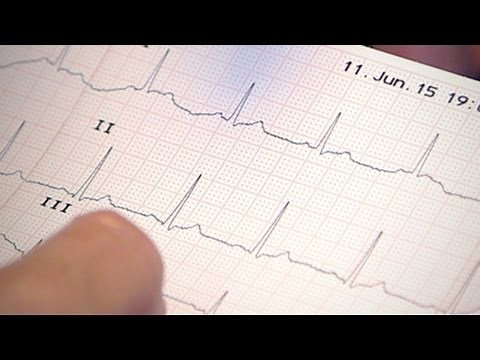 ECG Assessment: an Introduction for Healthcare Providers - free online course at FutureLearn.com