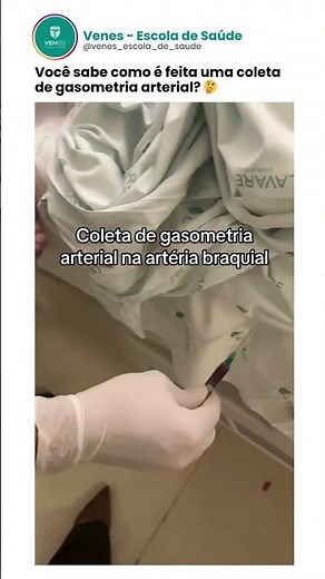 Você sabe como é feita uma coleta de gasometria arterial? 🤔