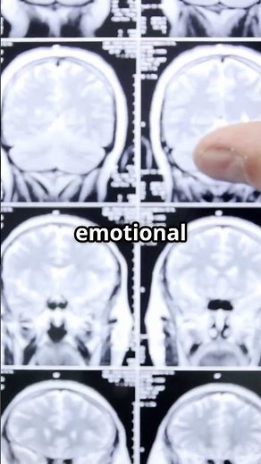 Why Chewing Sounds Trigger You | Misophonia in 60 Seconds #SummerOnShorts