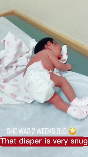 Confusing behavior in 2-week-old infants#diaper #momsoftiktok #babydiaper #nappies