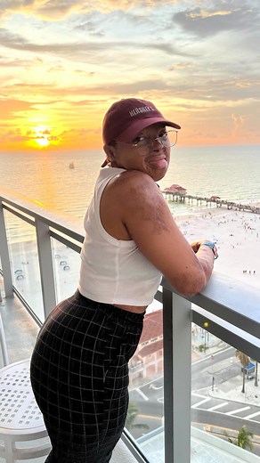 I forgot my bathing suit and I’m in Florida right next to a beach 🥲 I could’ve peppered you guys 😩next summer I guess | Kechi Okwuchi