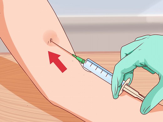 3 Ways to Recognize Tetanus (Lockjaw) - wikiHow