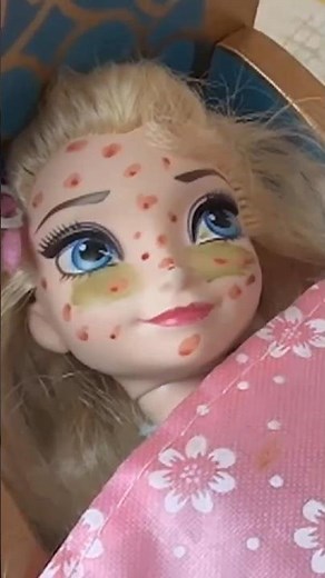 Elsa is all Spotty !!! Call Doctor Barbie #elsaandanna #barbie #dolls #shorts