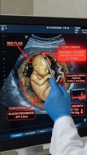 17 Weeks Pregnant? These Signs = DANGER 🚨