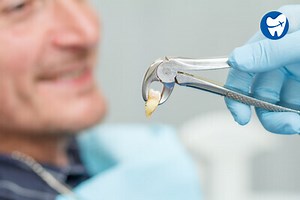 Low cost tooth extraction abroad | Affordable & Quality Dental Work