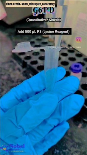 g6pd test method #lab #test #bmls #hospital #trending #ytshorts