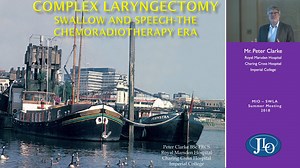 Complex Laryngectomy: Swallow and Speech - The Chemoradiotherapy Era