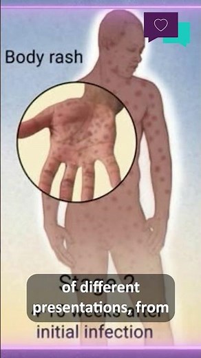 What are the signs of syphilis?