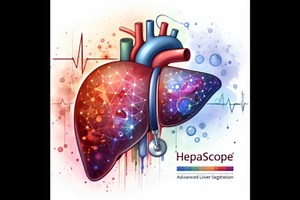 HepaScope: Advanced Liver Segmentation Project