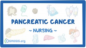 Pancreatic cancer: Nursing: Video & Causes | Osmosis