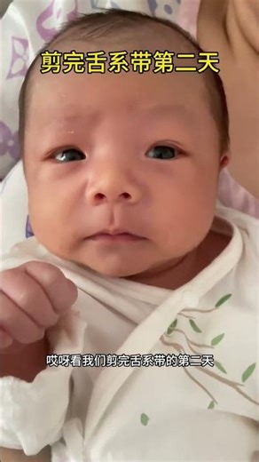 The day after the lingual frenulum was cut the baby recovered very well#Newborn records#A