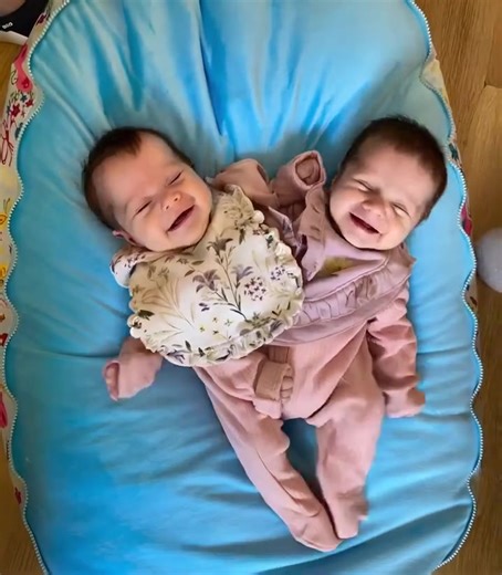 These Siamese twins were born joined at the chest, sharing a liver, intestines, and several crucial organs 😲. Additionally, each girl had only one leg between them 😱. At just six months old, surgeons made the decision to separate them. The complex surgery took 18 hours, but the medical team successfully divided the twins 😍. Now, at 3 years old, the sisters are thriving. Curious to see how they look after all these years? Check out their post-separation photos in the first comment below 👇👇👇