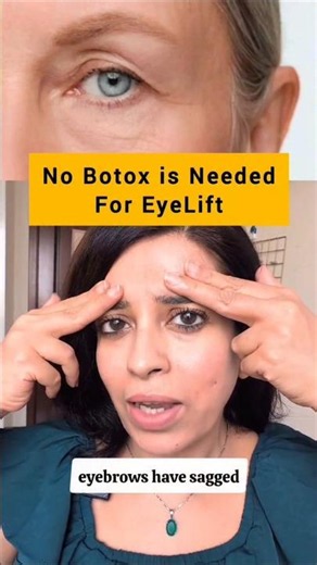 Natural Eye Lift: Fix Hooded Eyes Without Botox! ✨ #FaceYoga #HoodedEyes