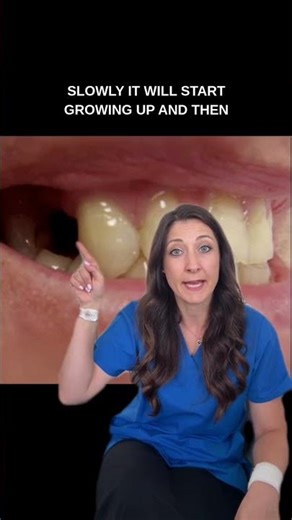 What to do if you loose your tooth? #dentalimplant #doctorexplains #london