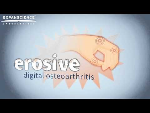 Erosive digital osteoarthritis