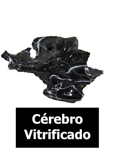 Em 2020, uma descoberta extraordinária em Herculano, Itália, revelou o cérebro de uma vítima da erupção do Vesúvio em 79 d.C. transformado em vidro. O achado, ocorrido no crânio de um jovem adulto encontrado no Collegium Augustalium, intrigou cientistas. Estudos subsequentes revelaram que o calor intenso da erupção, seguido de um rápido resfriamento, vitrificou o tecido cerebral, preservando-o em uma forma vítrea única. Essa descoberta oferece uma visão sem precedentes sobre os efeitos devastado