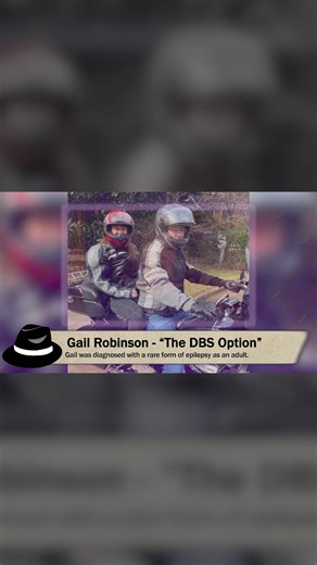 Quite commonly epilepsy can't be treated by medicine alone. This lady tells how her DBS helped her return to a more fun and productive life. #Epilepsy #EpilepsyAwareness #Seizures #SeizureAwareness #EpilepsySupport #cerebralpalsey #EpilepsyAdvocate #EpilepsyGangster #DrDanielDrane #Emory | Epilepsy Gangster | Facebook