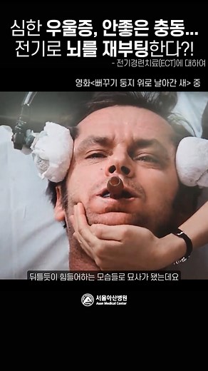 우울증 극복을 위한 1초의 전기자극, 전기경련치료 ECT | 서울아산병원 | 서울아산병원 Asan Medical Center