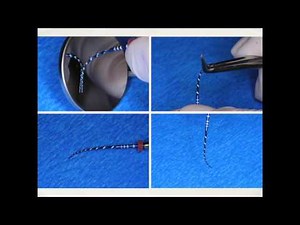 Vortex Blue® - Dr Frank Cervone VB Technique | Dentsply Sirona