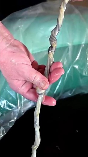 Cordón umbilical