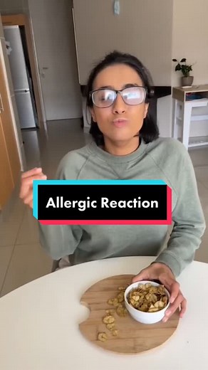 Shiv's Allergic Reaction and Bluetooth Beacon Hotel Room