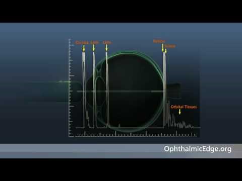 Lecture 4:How Does an A-Scan Become a B-Scan?