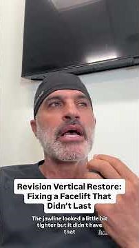 What Happens When a Facelift Fails?