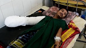 'Tree man' smiles from bed after operation removing warts