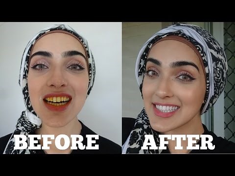 How To WHITEN Yellow Teeth NATURALLY & INSTANTLY AT HOME in 2 MINS | OIL PULLING ~ Immy