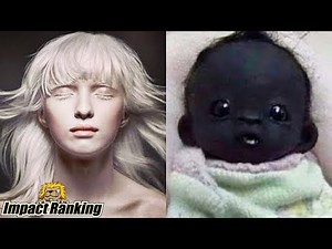 美しく神秘的な世界のアルビノ、逆アルビノに関する事７選