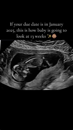 January 2025 Baby Ultrasound at 13 Weeks: A Glimpse Into Your Pregnancy Journey