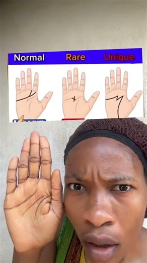 Normal, rare, or unique?? Comment below #mimidooashiekaatv #funny #relatable