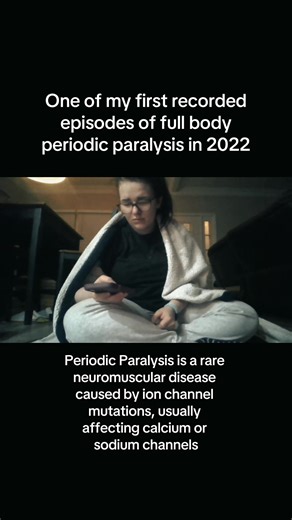 A video example of #hypokalemicperiodicparalysis prior to treatment, and an example of what full body periodic paralysis looks like! #hypoPP #rarediseaseawareness #neuromusculardisease #andersentawilsyndrome