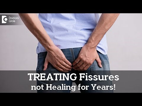 Best ways to manage Fissures that are not healing for long time - Dr. Nanda Rajneesh|Doctors' Circle
