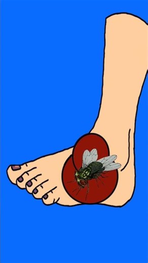 ASMR Insect Bite Treatment on Leg | Healing & Cleaning Sounds#asmr #funny