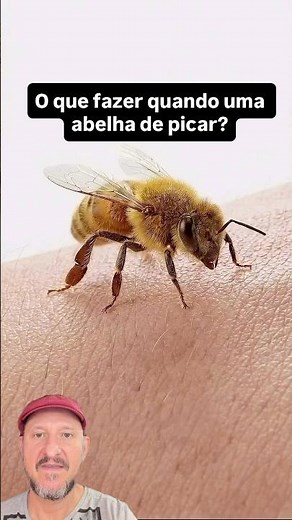 What to do when a bee stings you?