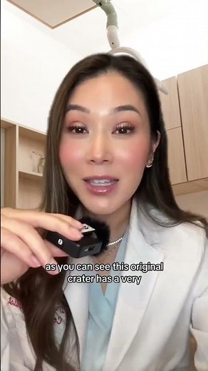 Does Invisalign cause gum recession? #orthodontics #invisalign #dentist #orthodontist #gumrecession