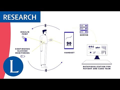Closed-loop insulin delivery in adults with type 1 diabetes