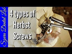 Orthodontic Herbst Appliance Screw lesson