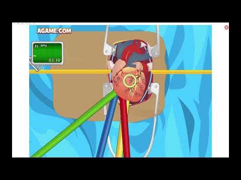 Operate Now: Heart Surgery