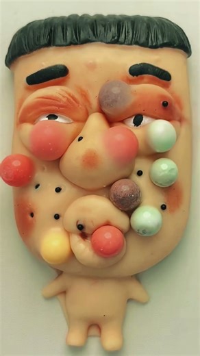 Slow Pimple Pop ASMR 😌🫧